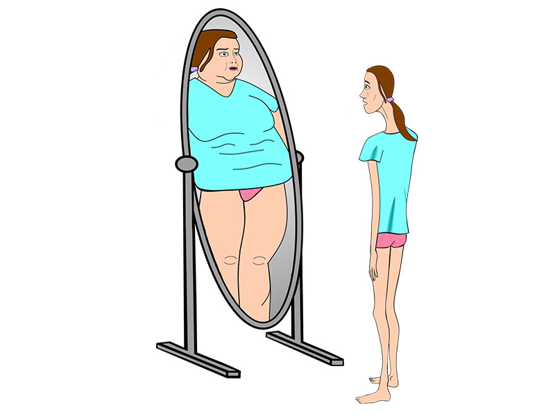 Anoressia Vasto