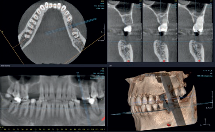 immagine prova opt 3d vasto polo biomedico Vasto