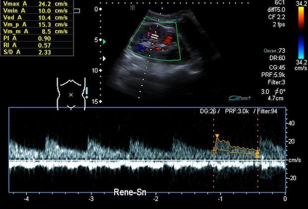 Ecocolor doppler Vasto Chieti Ecografia Vasto Radiologia Vasto