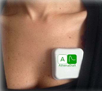 holter ecg 