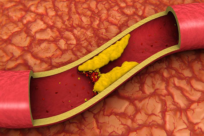 Il Colesterolo: perché è importante e come interpretare le analisi del sangue 